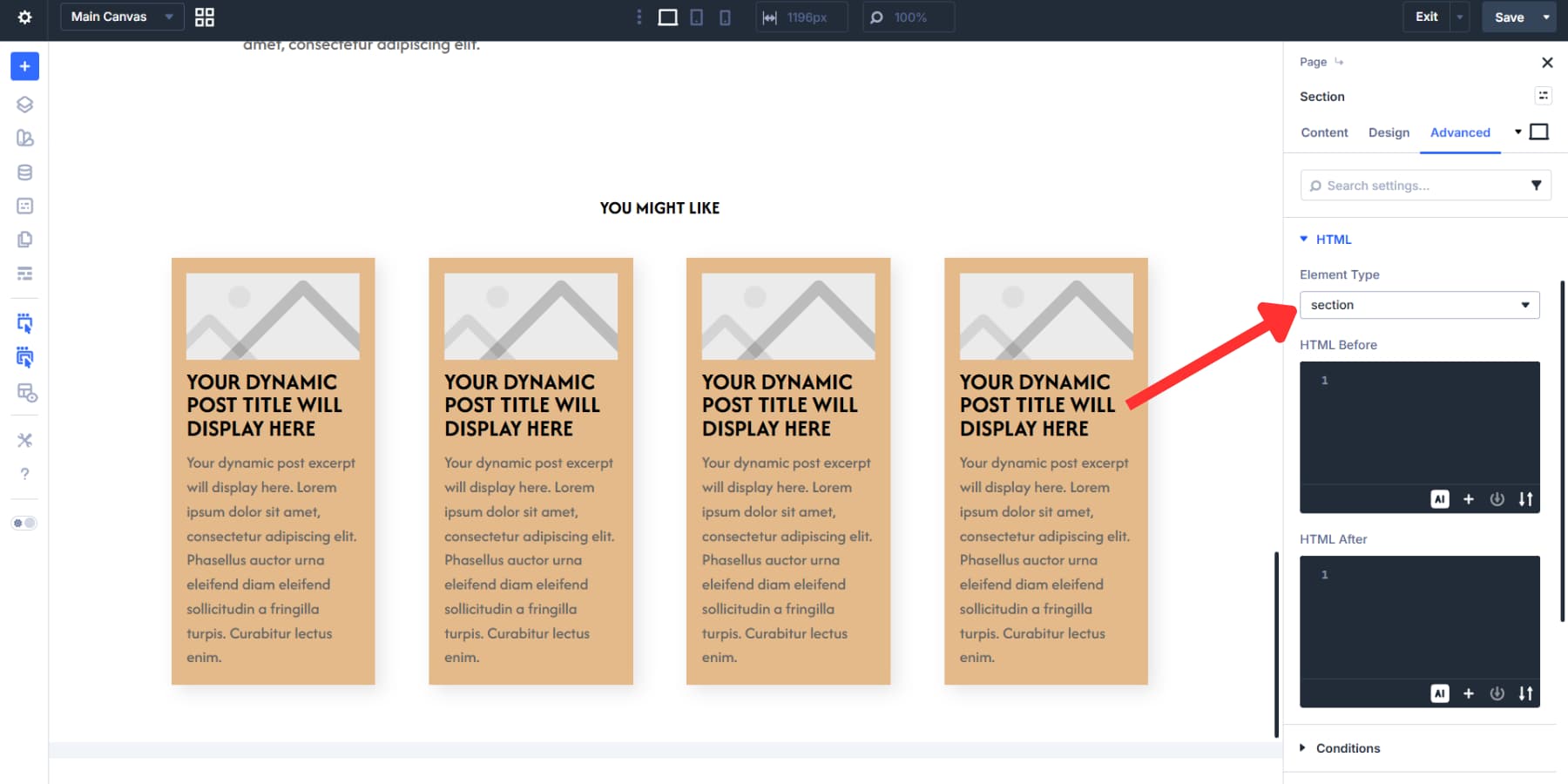 A screenshot of enabling section element type for the additional posts section